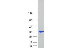 Western Blotting (WB) image for Tropomyosin 3 (TPM3) (Transcript Variant 2) protein (Myc-DYKDDDDK Tag) (ABIN2734392)