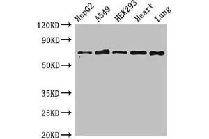 Western Blot Positive WB detected in: HepG2 whole cell lysate, A549 whole cell lysate, HEK293 whole cell lysate, Rat heart tissue, Rat lung tissue All lanes: EIF2AK1 antibody at 3 μg/mL Secondary Goat polyclonal to rabbit IgG at 1/50000 dilution Predicted band size: 72 kDa Observed band size: 72 kDa (EIF2AK1 Antikörper  (AA 1-86))