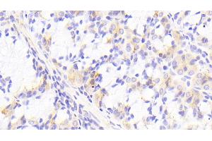 Detection of PTPRK in Human Stomach Tissue using Polyclonal Antibody to Protein Tyrosine Phosphatase Receptor Type K (PTPRK) (PTPRK Antikörper  (AA 1185-1440))