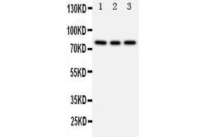 Western Blotting (WB) image for anti-Phosphoinositide 3 Kinase, p85 beta (PI3K p85b) (AA 447-461), (Middle Region) antibody (ABIN3044260) (PIK3R2 Antikörper  (Middle Region))