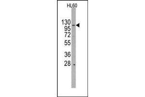 Image no. 1 for anti-HIR Histone Cell Cycle Regulation Defective Homolog A (HIRA) (Middle Region) antibody (ABIN358780) (HIRA Antikörper  (Middle Region))