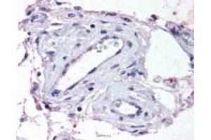 Immunohistochemistry (IHC) image for anti-ADAM Metallopeptidase with Thrombospondin Type 1 Motif, 1 (ADAMTS1) (Internal Region) antibody (ABIN2469275)