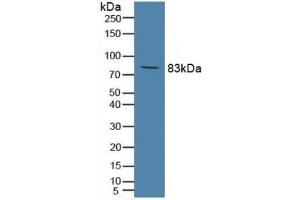 Detection of C2 in Rat Serum using Polyclonal Antibody to Complement Component 2 (C2) (Complement C2 Antikörper  (AA 473-723))