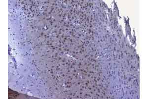 IHC analysis of NRF1 using anti-NRF1 antibody (ABIN6719347). (NRF1 Antikörper  (AA 246-503))