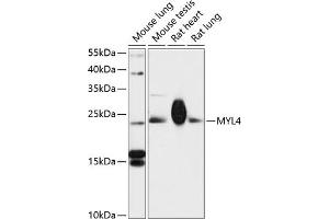 Western blot analysis of extracts of various cell lines, using MYL4 antibody (ABIN6129614, ABIN6144252, ABIN6144254 and ABIN6217179) at 1:3000 dilution.