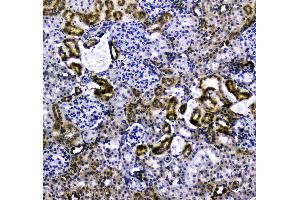 IHC analysis of VCAM1 using anti-VCAM1 antibody . (VCAM1 Antikörper  (AA 25-270))