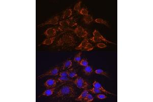 Immunofluorescence analysis of C6 cells using HPS4 antibody (ABIN7267623) at dilution of 1:100. (HPS4 Antikörper  (AA 550-650))