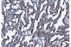 IHC analysis of Axin 2/AXIN2 using anti-Axin 2/AXIN2 antibody (ABIN7602177). (AXIN2 Antikörper  (AA 614-843))