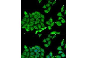 Immunofluorescence analysis of U2OS cells using RPS7 Polyclonal Antibody (RPS7 Antikörper)