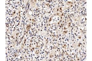 IHC analysis of Cbx8 using anti-Cbx8 antibody (ABIN7599341). (CBX8 Antikörper  (AA 1-389))