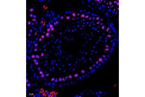 Immunofluorescence of paraffin embedded mouse testis using CHD1L (ABIN7073491) at dilution of 1:650 (400x lens) (CHD1L Antikörper)