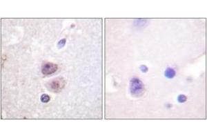 Immunohistochemistry (IHC) image for anti-Mitogen-Activated Protein Kinase 14 (MAPK14) (AA 288-337) antibody (ABIN2888769) (MAPK14 Antikörper  (AA 288-337))