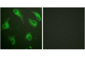 Immunofluorescence analysis of HeLa cells, using CD88/C5aR (Ab-338) Antibody. (C5AR1 Antikörper  (AA 301-350))