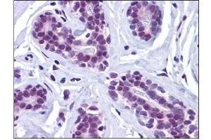 Human Breast: Formalin-Fixed, Paraffin-Embedded (FFPE) (Retinoblastoma Binding Protein 8 Antikörper)