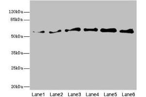 Western blot All lanes: PIP5K1B antibody at 5. (PIP5K1B Antikörper  (AA 190-470))