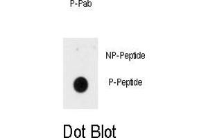 Image no. 1 for anti-Insulin Receptor (INSR) (pTyr1185) antibody (ABIN358482) (Insulin Receptor Antikörper  (pTyr1185))
