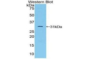 Western Blotting (WB) image for anti-TGF-beta Activated Kinase 1/MAP3K7 Binding Protein 1 (TAB1) (AA 189-439) antibody (ABIN1859749) (TAB1 Antikörper  (AA 189-439))