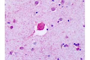 Immunohistochemistry (IHC) image for anti-Purinergic Receptor P2Y, G-Protein Coupled, 8 (P2RY8) (Cytoplasmic Domain) antibody (ABIN1049222)