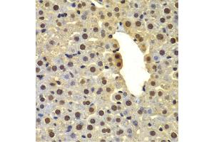 Immunohistochemistry of paraffin-embedded mouse liver using DTX2 antibody (ABIN6127799, ABIN6139853, ABIN6139854 and ABIN6223266) at dilution of 1:100 (40x lens). (DTX2 Antikörper  (AA 1-280))