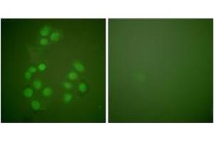 Immunofluorescence analysis of A549 cells, using CREB-BP Antibody. (CBP Antikörper  (AA 2393-2442))