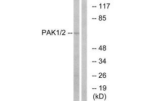Western Blotting (WB) image for anti-P21 Protein (Cdc42/Rac)-Activated Kinase 1/2 (PAK1/2) (Ser199) antibody (ABIN1848058) (PAK1/2 Antikörper  (Ser199))