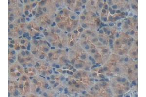 Used in DAB staining on fromalin fixed paraffin- embedded kidney tissue (IGFBP5 Antikörper  (AA 25-271))