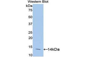 Western Blotting (WB) image for anti-Eukaryotic Translation Initiation Factor 4E Binding Protein 1 (EIF4EBP1) (AA 2-118) antibody (ABIN3202359) (eIF4EBP1 Antikörper  (AA 2-118))