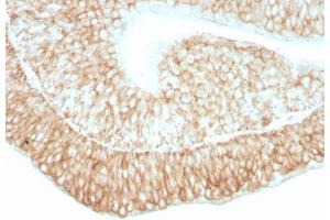 Formalin-fixed, paraffin-embedded human bladder stained with CD59 Mouse Monoclonal Antibody (193-27). (CD59 Antikörper)