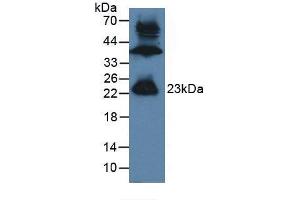 Western blot analysis of Mouse Testis Tissue. (GREM1 Antikörper  (AA 26-184))