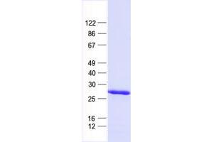 Validation with Western Blot