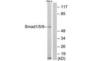 Western blot analysis of extracts from HeLa cells, using Smad1/5/9 Antibody. (SMAD1 Antikörper  (AA 10-59))