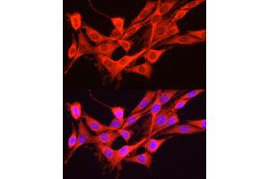 Immunofluorescence (IF) image for anti-Eukaryotic Translation Initiation Factor 2 alpha Kinase 4 (EIF2AK4) (AA 1-300) antibody (ABIN6140031)