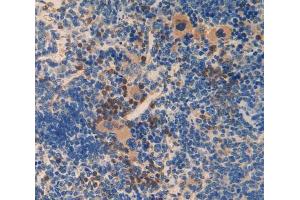 Used in DAB staining on fromalin fixed paraffin- embedded spleen tissue (SMAD6 Antikörper  (AA 171-441))