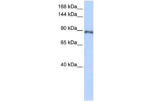 WB Suggested Anti-SOLH Antibody Titration:  0. (Calpain 15/SOLH Antikörper  (Middle Region))