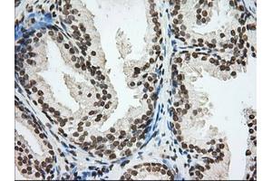 Immunohistochemical staining of paraffin-embedded Human Kidney tissue using anti-CYP1A2 mouse monoclonal antibody. (CYP1A2 Antikörper)