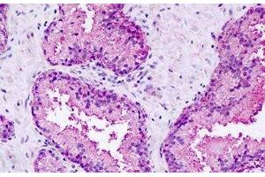 Human, Prostate: Formalin-Fixed Paraffin-Embedded (FFPE)