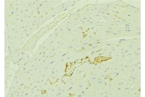 ABIN6276384 at 1/100 staining Mouse liver tissue by IHC-P. (TNFRSF6B Antikörper)
