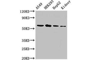 P4HA1 antibody  (AA 256-525)