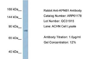 Western Blotting (WB) image for anti-Karyopherin (Importin) beta 1 (KPNB1) (N-Term) antibody (ABIN786355) (KPNB1 Antikörper  (N-Term))