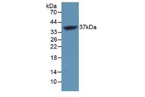 Detection of Recombinant FOSL1, Mouse using Polyclonal Antibody to FOS Like Antigen 1 (FOSL1) (FOSL1 Antikörper  (AA 1-273))