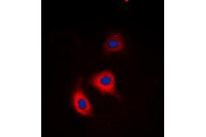 Immunofluorescent analysis of Alpha-adducin (pS726/713) staining in HeLa cells. (alpha Adducin Antikörper  (C-Term, pSer713, pSer726))