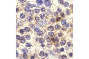 Immunohistochemistry of CX3CR1 in human spleen cells with CX3CR1 antibody at 10 μg/ml. (CX3CR1 Antikörper  (Extracellular Loop))