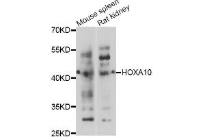 Western blot analysis of extracts of various cell lines, using HOXA10 antibody. (HOXA10 Antikörper)