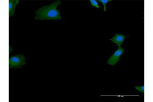 Immunofluorescence of purified MaxPab antibody to SKIV2L on HeLa cell. (SKIV2L Antikörper  (AA 1-1246))