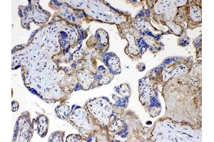 IHC analysis of CD151 using anti- CD151 antibody . (CD151 Antikörper  (AA 113-175))