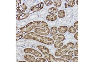 Immunohistochemistry (IHC) image for anti-Fructose-1,6-Bisphosphatase 1 (FBP1) antibody (ABIN7267269)