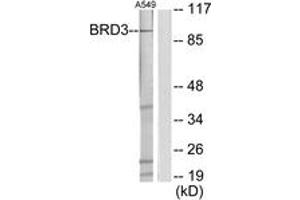 Western blot analysis of extracts from A549 cells, using BRD3 Antibody. (BRD3 Antikörper  (AA 611-660))