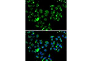 Immunofluorescence analysis of  cells using C antibody (ABIN6127550, ABIN6137939, ABIN6137940 and ABIN6222956). (CARD11 Antikörper  (AA 985-1154))