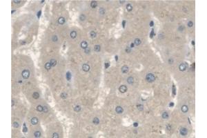 Immunohistochemistry (IHC) image for anti-Insulin-Like Growth Factor Binding Protein 2, 36kDa (IGFBP2) (AA 148-325) antibody (ABIN7430594)