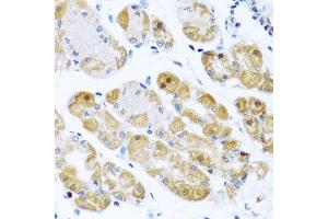 Immunohistochemistry of paraffin-embedded human gastric using RPS2 antibody at dilution of 1:100 (x40 lens). (RPS2 Antikörper)